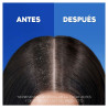 Shampoo Head & Shoulders S Anticaída 1 L