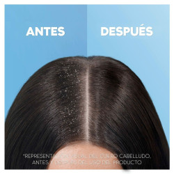 Shampoo Head & Shoulders H&S Clásico 1 L